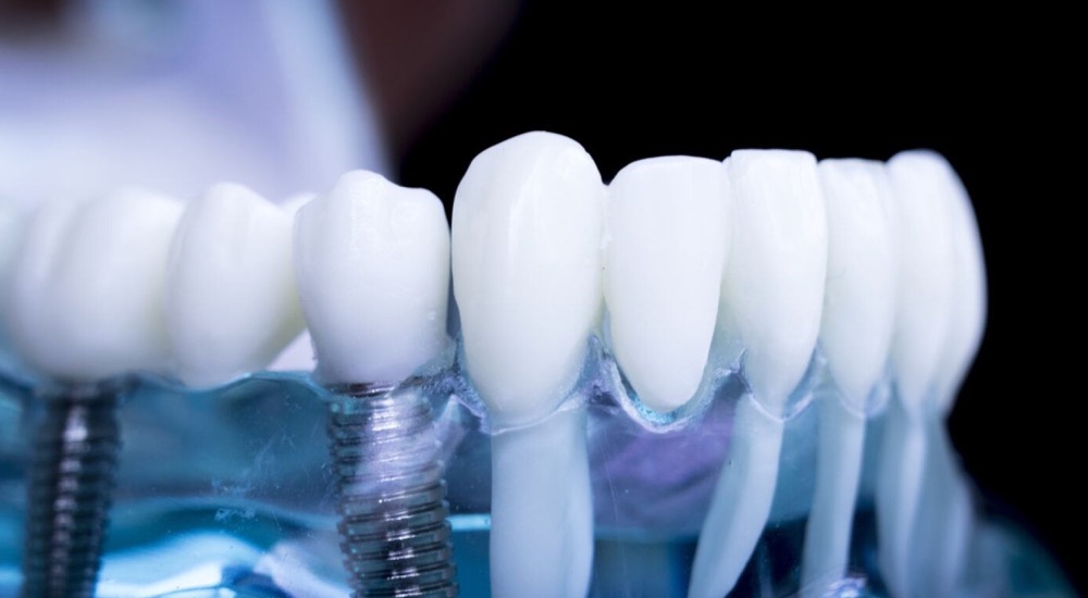 AI Applications in Dental Care